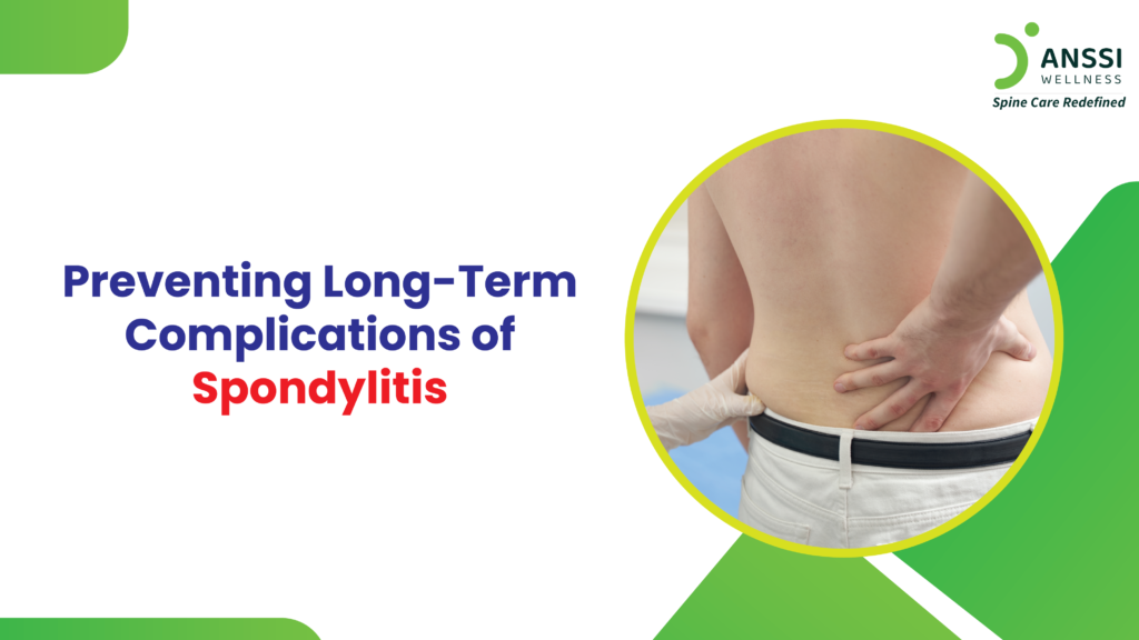 Spondylitis is a chronic inflammatory condition that affects the spine and can lead to severe complications if not managed properly.